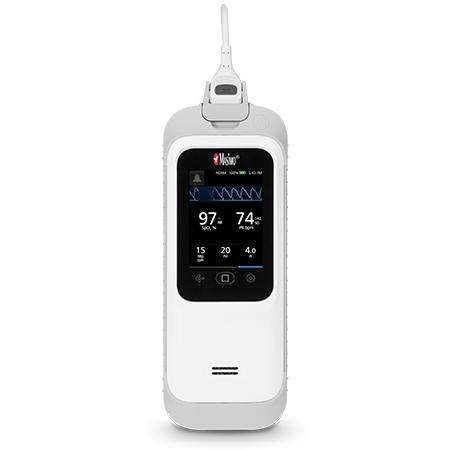 Masimo Rad-G Pulse Oximeter